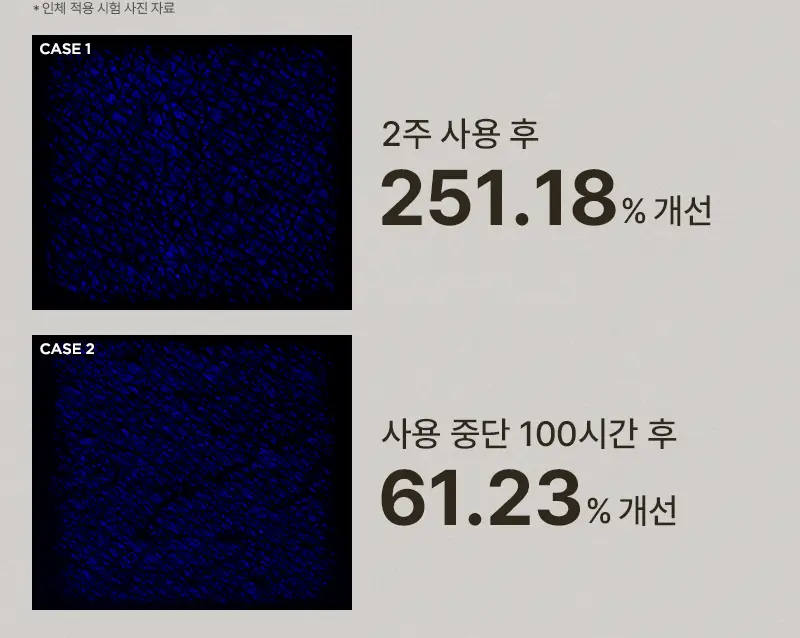 [민감/건조 피부 추천] 미차이 시카 살브 크림 230ML 상세페이지 14
